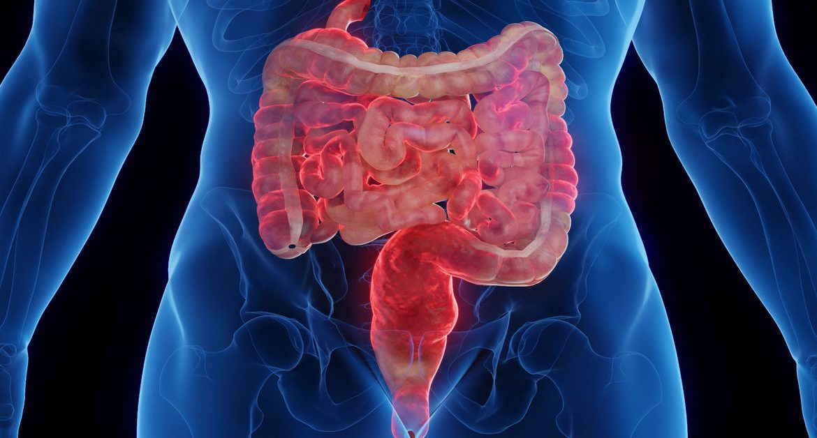 Crohn Hastalığı Tedavisi