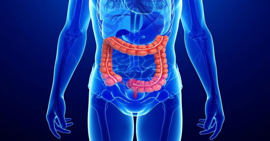 Symptome von Morbus Crohn