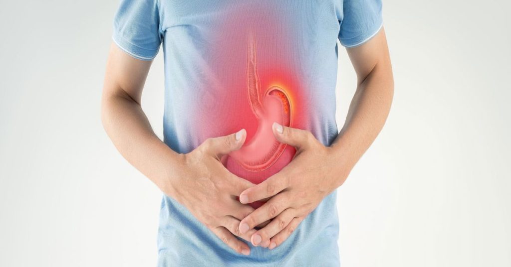 Mide Ülseri Hastalığı Nedir?