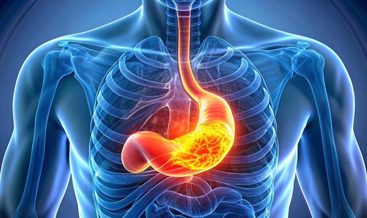 Endoscopic Reflux Treatment