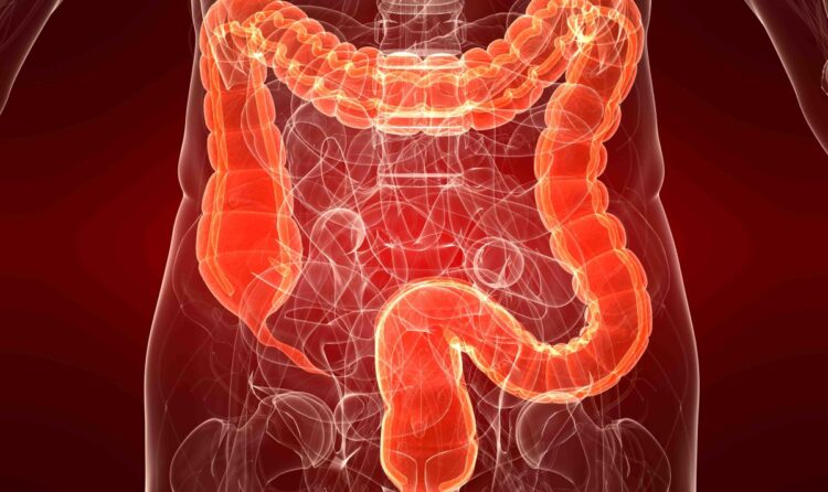 Ülseratif Kolit Nedir?