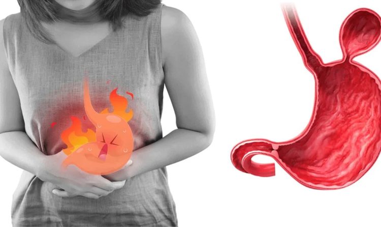 Mide Fıtığı Ameliyatı