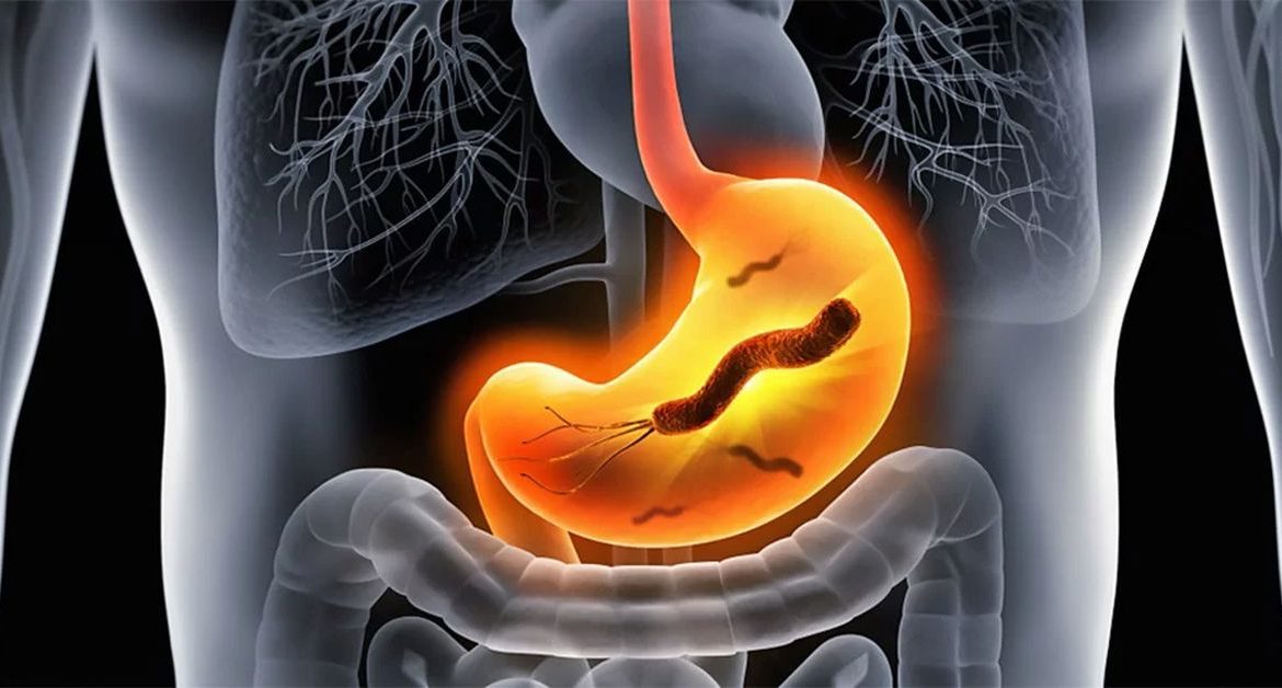 Traitement de l'Helicobacter Pylori