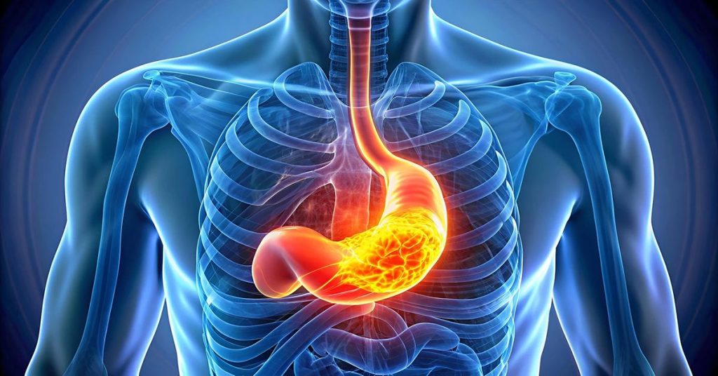 Mide Fıtığı Nedir?