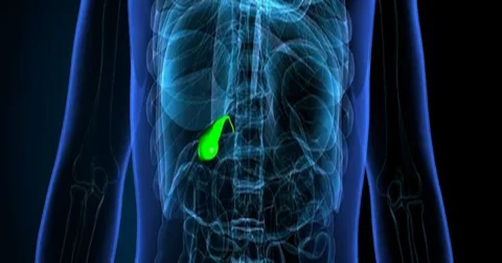 Gallbladder Inflammation