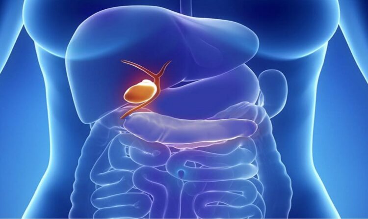 Воспаление желчного пузыря