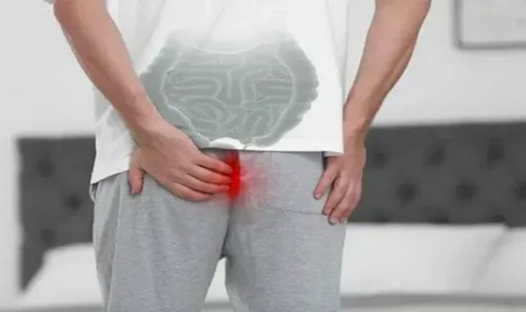 Хирургия геморроя