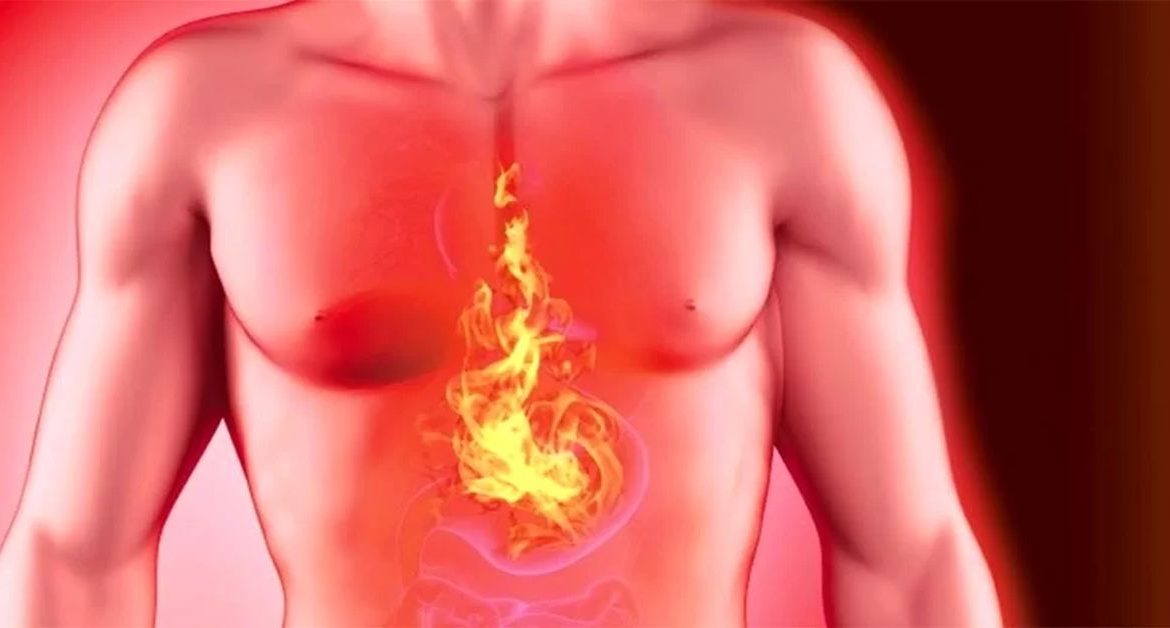 Mide Ülseri Ameliyatı