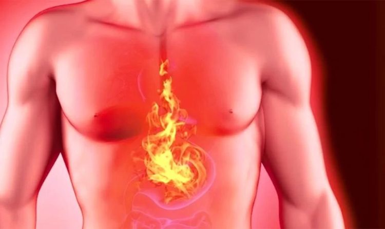 Хирургия язвы желудка