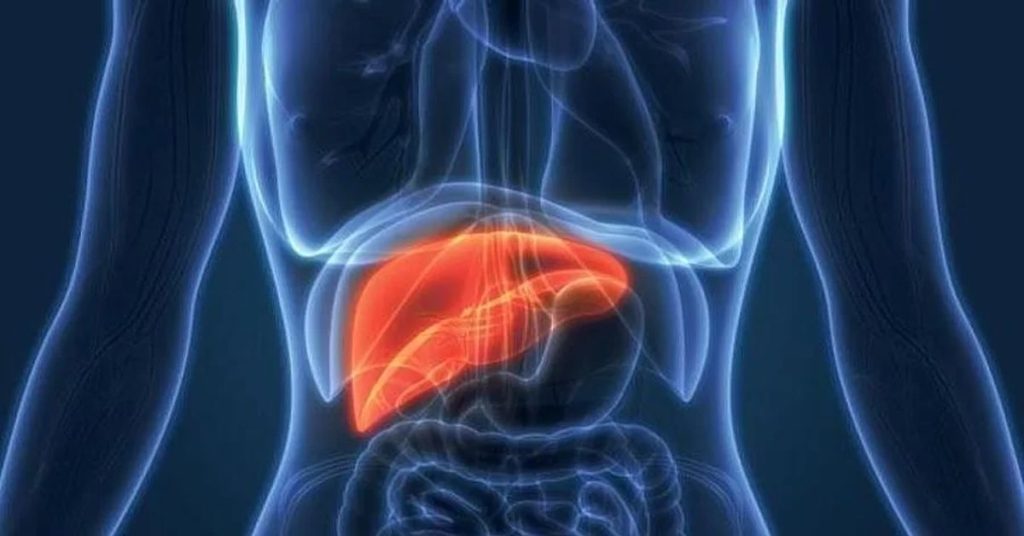 Liver Cirrhosis