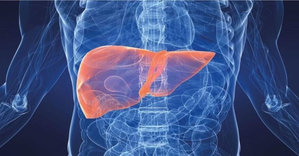 Liver Cirrhosis