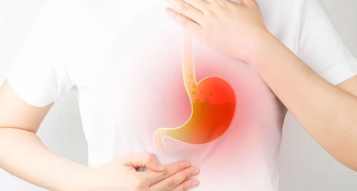 Wie entsteht Reflux?