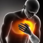 Reflü ameliyatı nedir