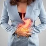 Что такое рефлюкс?