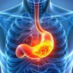 Reflü Tedavisi Nedir?