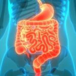 Ulcerative Colitis Treatment